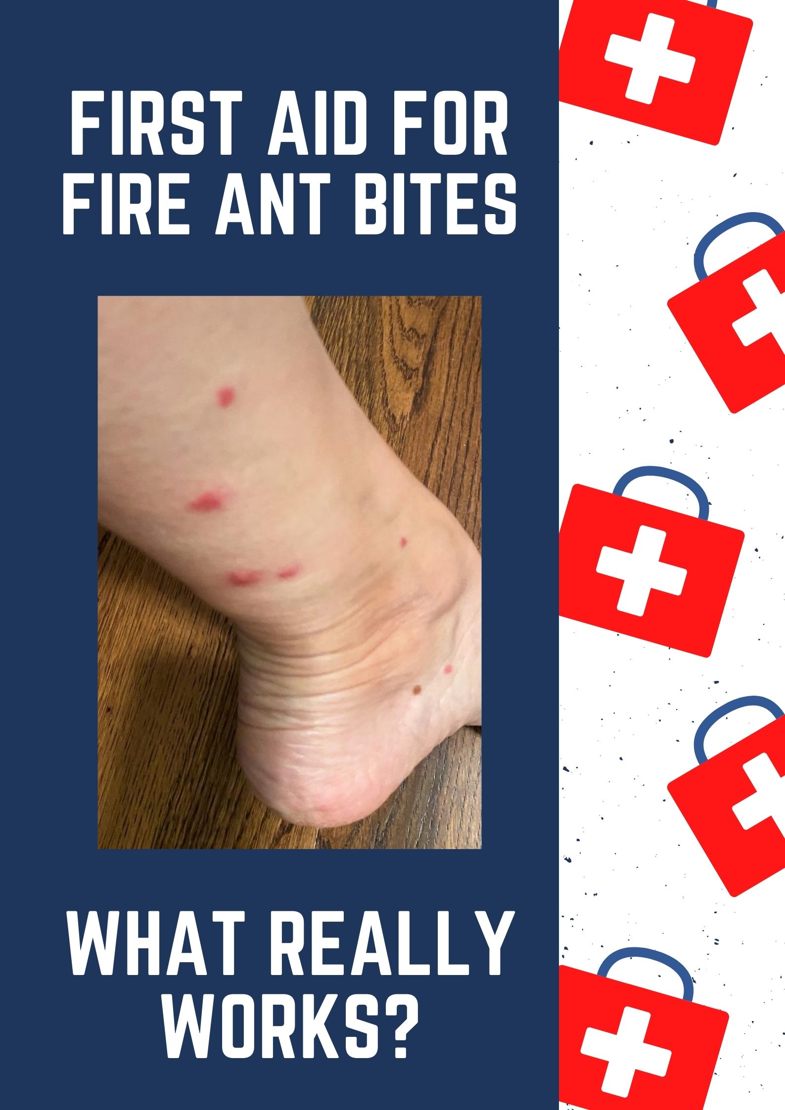 Ever had a fire ant bite? They're horrible! They itch. They sting. They hurt... BUT, treating them is easy with items you have around the house! Find out what home remedies work best -- and what to avoid for fire ant stings. (But, if you are having trouble breathing, call 911.)