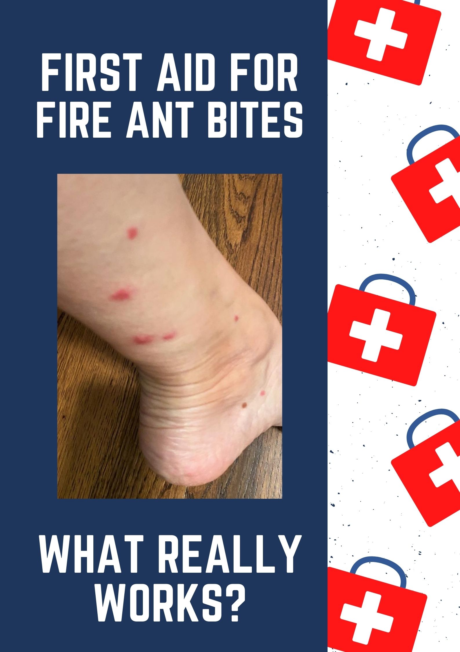 big red ant bite