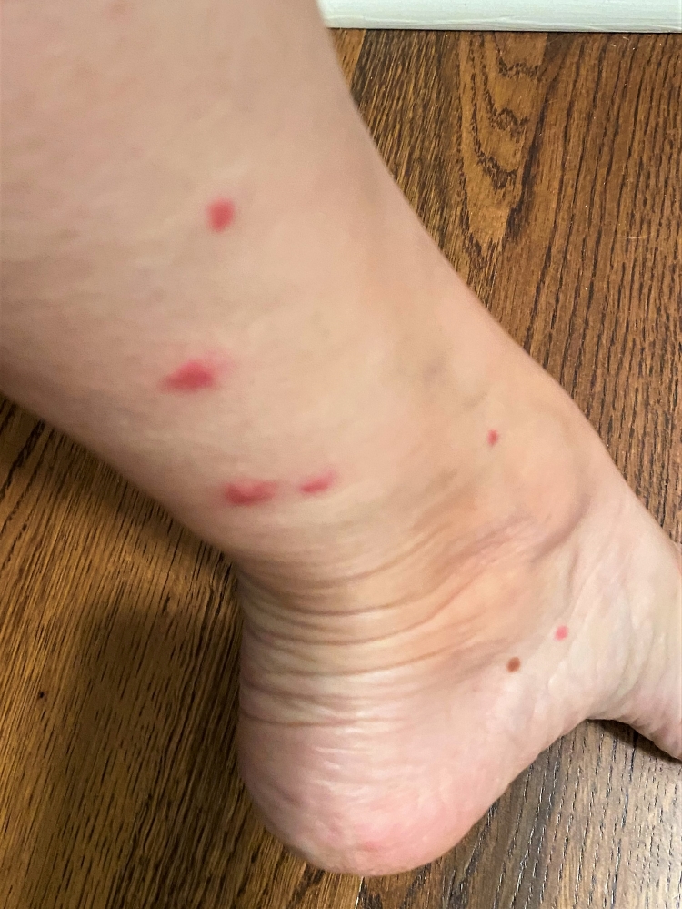 fire ants bites on dogs