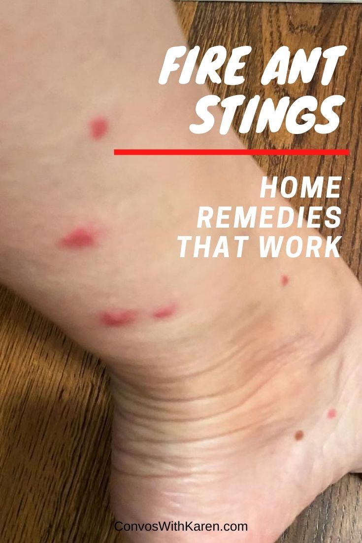 Ever had a fire ant bite? They're horrible! They itch. They sting. They hurt... BUT, treating them is easy with items you have around the house! Find out what home remedies work best -- and what to avoid for fire ant stings. (But, if you are having trouble breathing, call 911.)
